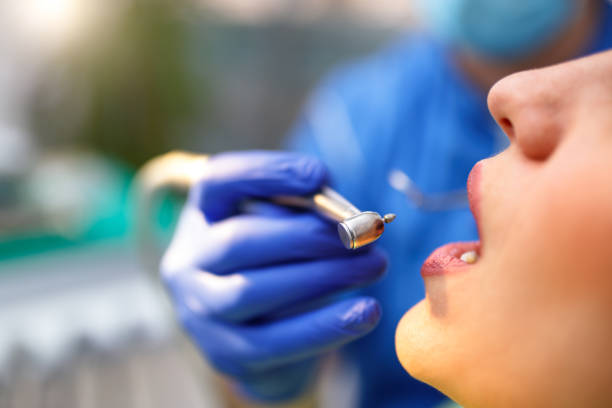 Dental Bonding in Bonne Terre, MO